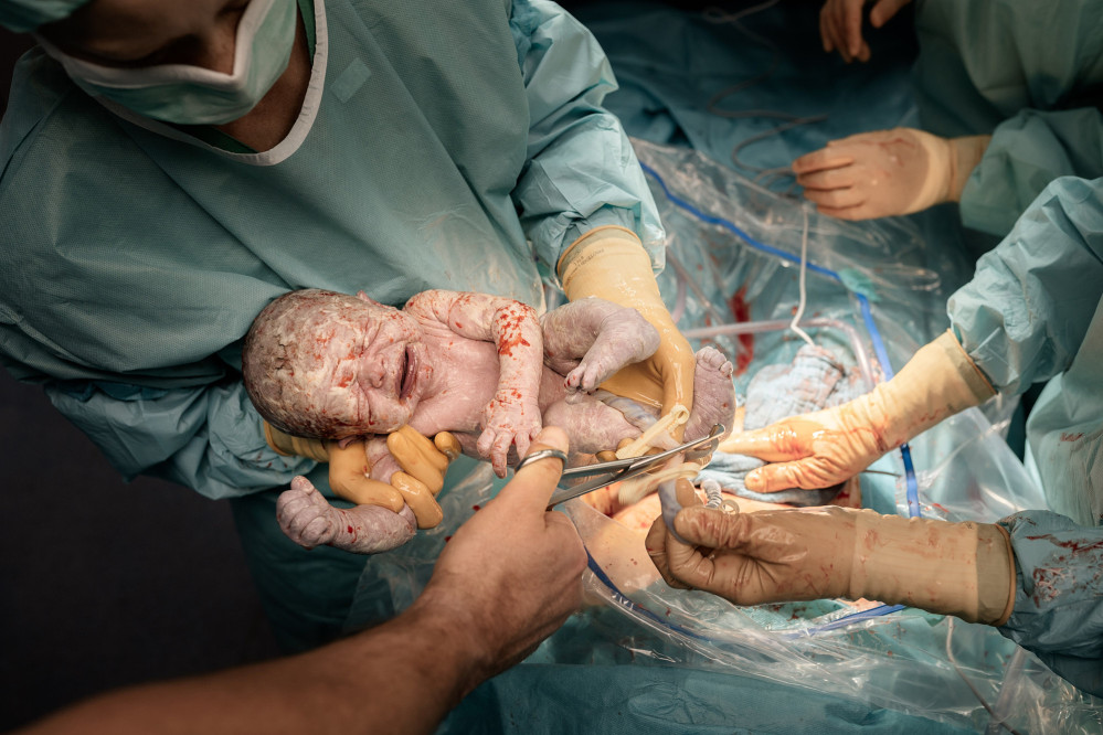 geburtsfotografie-im-rahmen-des-fotografie-studiums-591